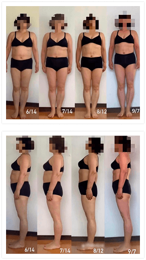 一人目のビフォーとアフターの女性画像