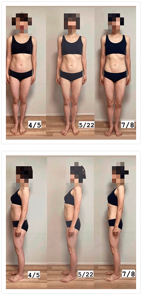 二人目のビフォーとアフターの女性画像