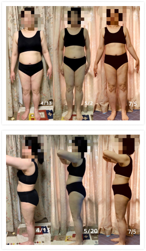 三人目のビフォーとアフターの女性画像